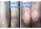 Психо-функциональная разблокировка